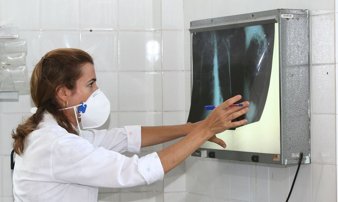 Três Lagoas em Alerta: Casos de Tuberculose Aumentam e Saúde Municipal Intensifica Monitoramento