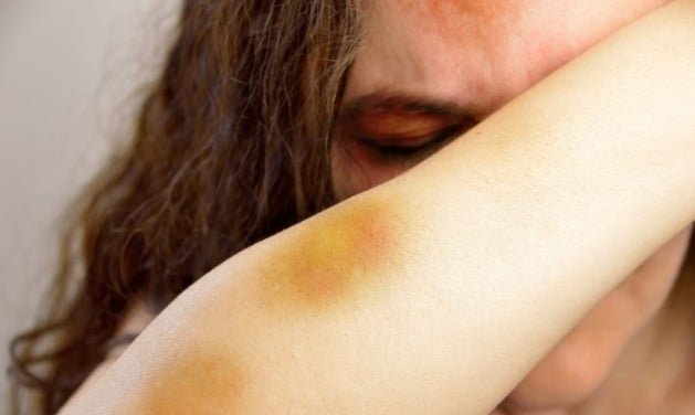 Alerta em Três Lagoas: Casos de violência doméstica disparam nos primeiros meses de 2026