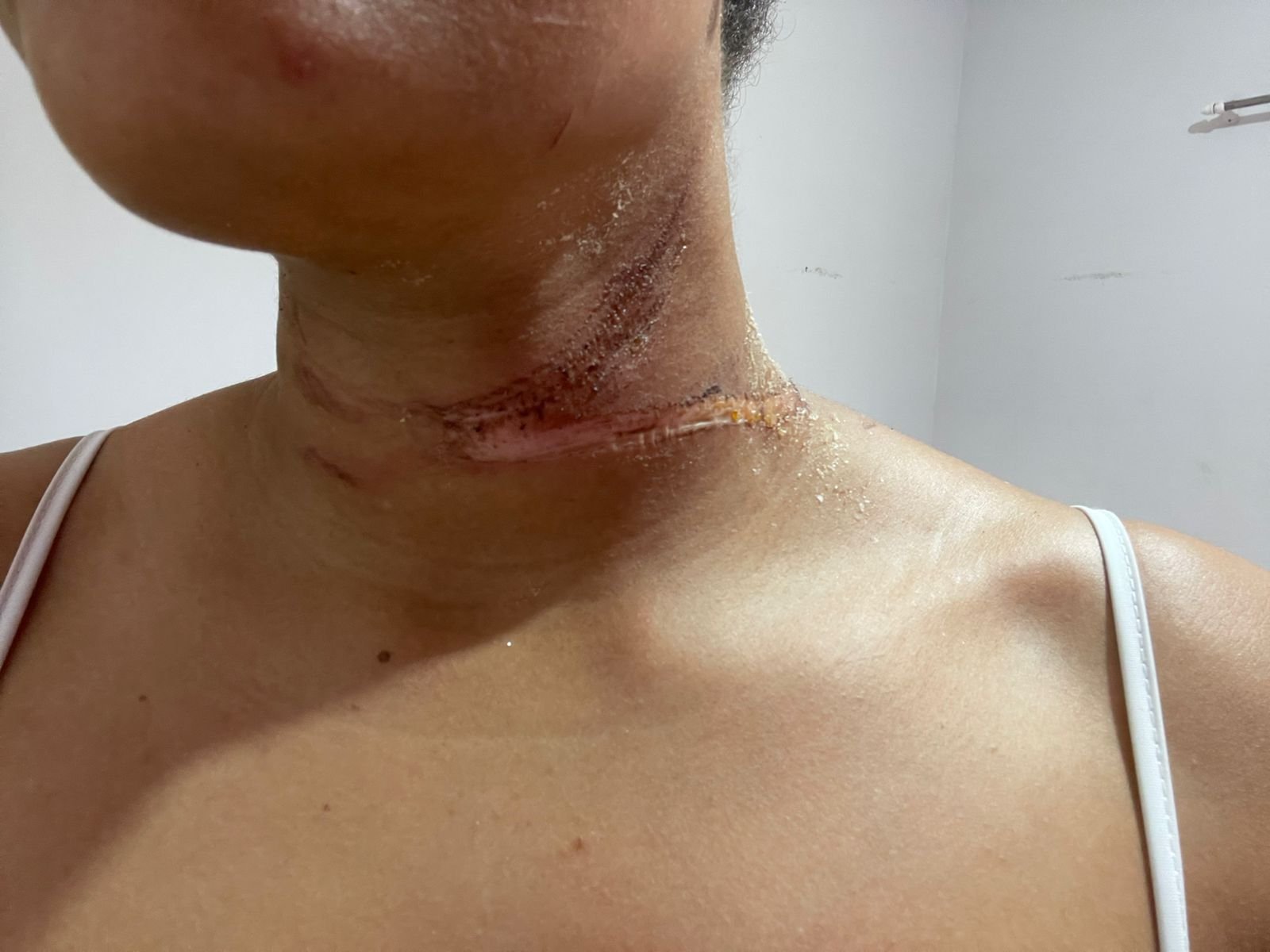 Fios soltos representam perigo e expõem negligência na infraestrutura urbana de Três Lagoas