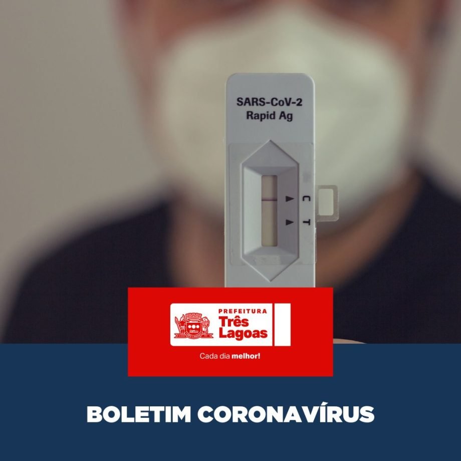 BOLETIM COVID-19 – 29 de abril de 2026